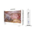 Camjoy CK927 27 pollici 4K UHD All-in-One telecamera endoscopica portatile