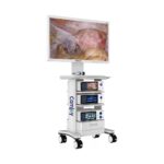 CF601 Sistema a torre con telecamera endoscopica Full HD