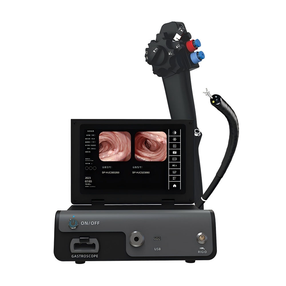 gastro-1 Gastroscopio digitale con processore all-in-one - immagine 1
