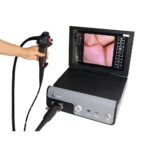 Gastroscopio digitale con processore all-in-one - immagine 2