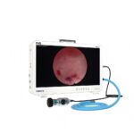 full HD endoscope camera