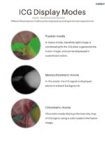 Camjoy CK701 4K ICG Sistema di Torre per Endoscopio a Fluorescenza Dual 4K - immagine 6