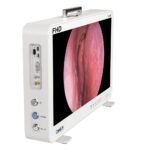 Camjoy CF916 Sistema portatile di telecamere endoscopiche 15.6 FHD ENT ORL Unit. FHD 03