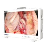 Camjoy CF927 27 Schermo grande FHD Sistema di telecamera endoscopica Visualizzazione chirurgica FHD 02