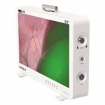 Camjoy CG932 Sistema di Telecamera per Endoscopio FPGA 4K-ICG da 32 pollici 02