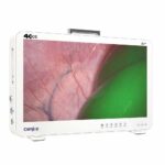 Camjoy CG932 Sistema di Telecamere per Endoscopio FPGA 4K-ICG da 32 pollici 03