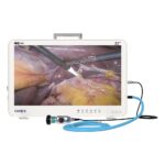 Camjoy CK932 32 Large Format 4K Endoscopy System Premium OR Equipment 4K 01