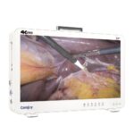 Camjoy CK932 32 Sistema di endoscopia 4K Formato Grande Attrezzatura OR Premium 4K 02