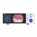Camjoy Fotocamera endoscopica Full HD FHD 01