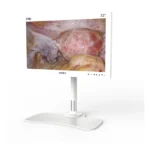 Camjoy CF0 22-inch white FHD surgical monitor perspective view
